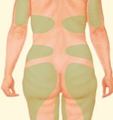 lipo-4