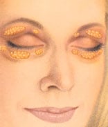 Blepharoplasty Surgery Preparation