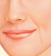 injectable_fillers-2