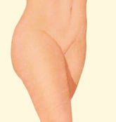 lipo-1