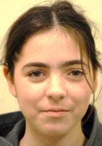 Facial Reconstruction BxA