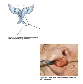 Tip Definition Tip Definition