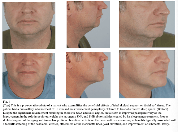 jaw-sugery-surgeon
