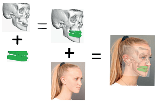 jaw-sugery-surgeon