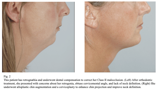 jaw-sugery-surgeon