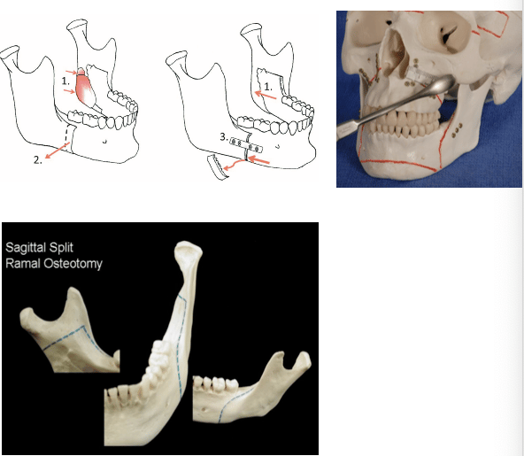 jaw-sugery-surgeon
