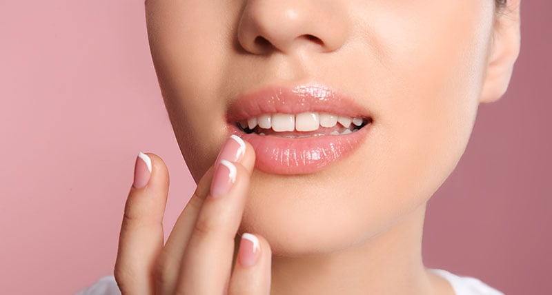 Lip Lift